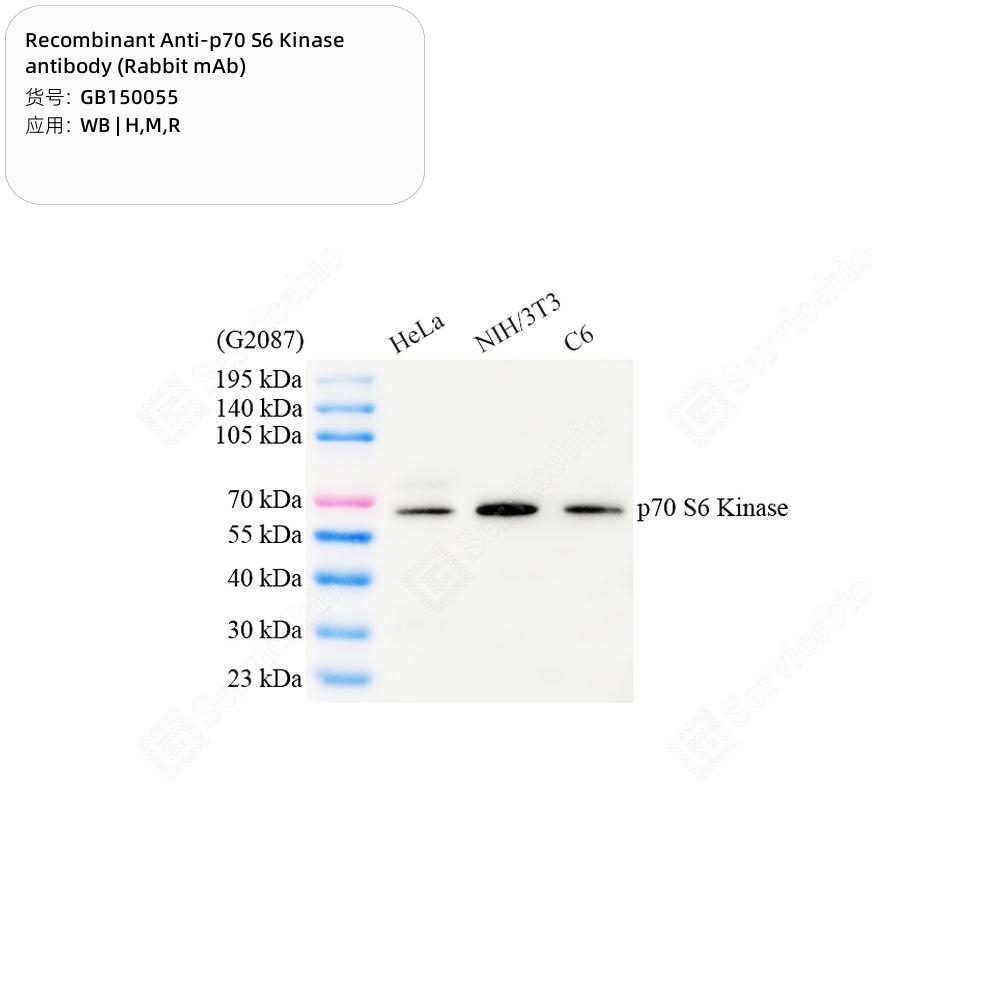 赛维尔生物服务|产品_Servicebio_武汉赛维尔生物科技有限公司