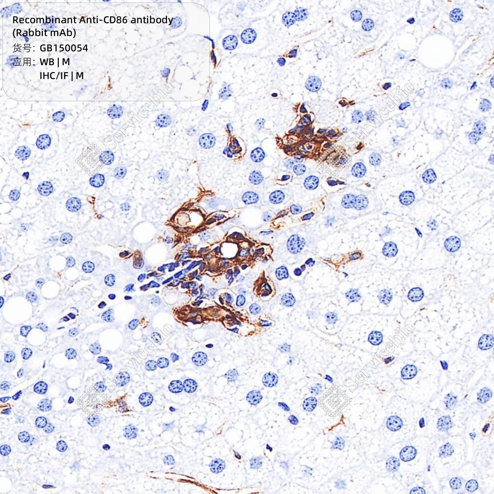 CD97 (Q14) Rabbit mAb main image 0