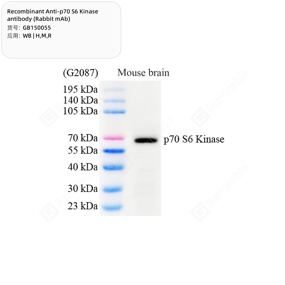 赛维尔生物服务|产品_Servicebio_武汉赛维尔生物科技有限公司
