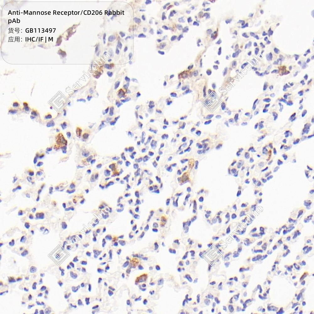 Mannose Receptor (N6) Rabbit mAb main image 1