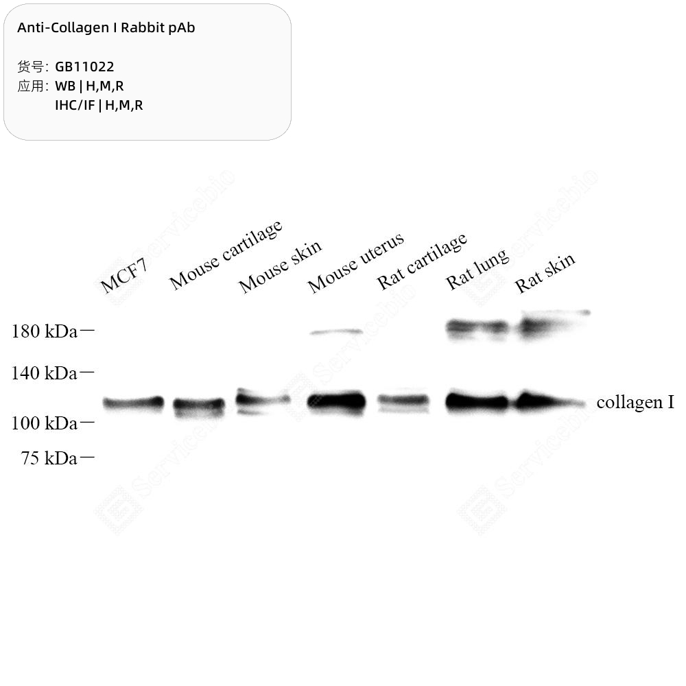 Collagen VI alpha 2 (Y12) Rabbit mAb