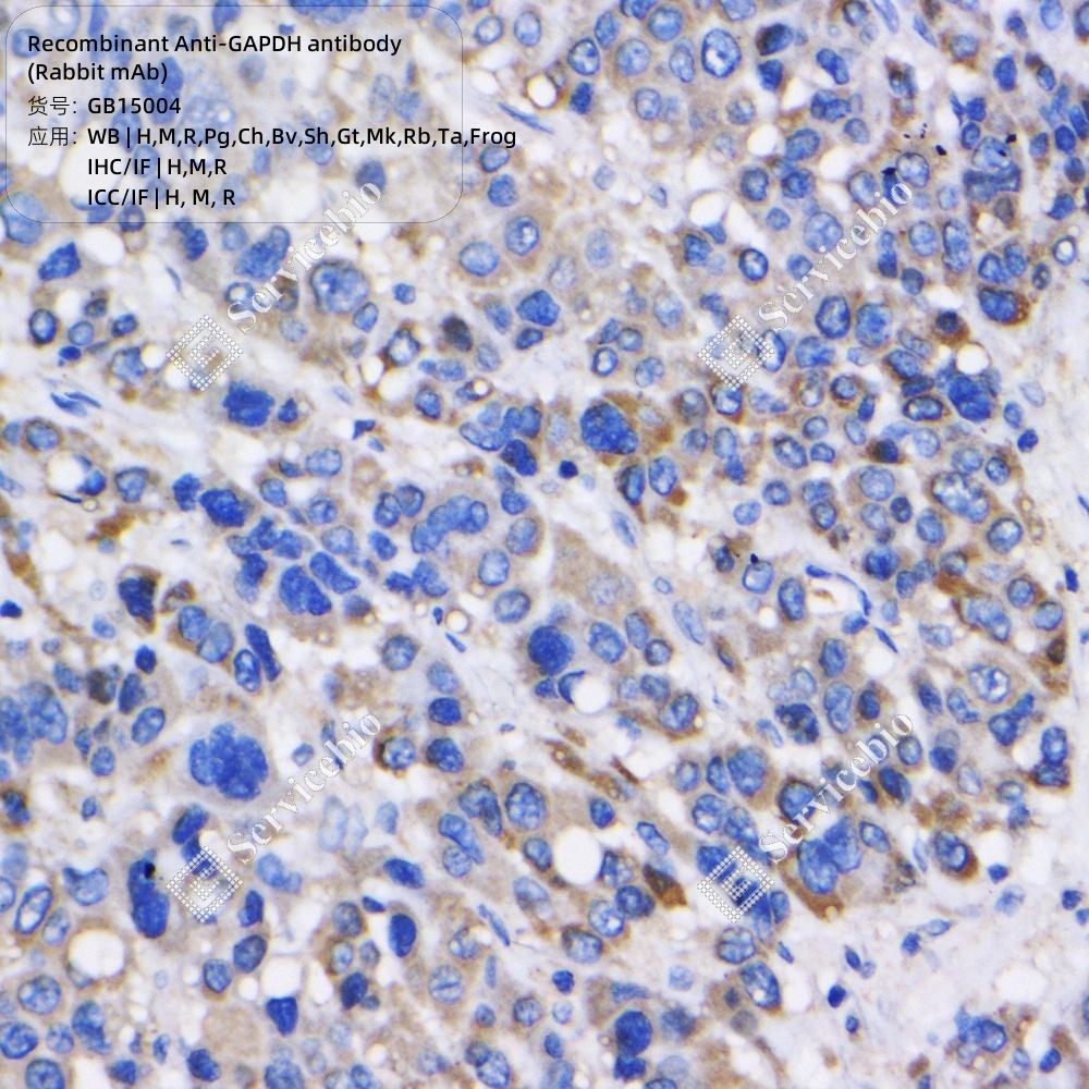 Gamma glutamyl hydrolase (V9) Rabbit mAb main image 1