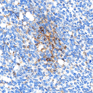 1 GB150059_PD-L1_mAb79_mAb7925071004_d1000_subcutaneous nude-mouse model of 4T1 cell_30.0x_IHC.jpg