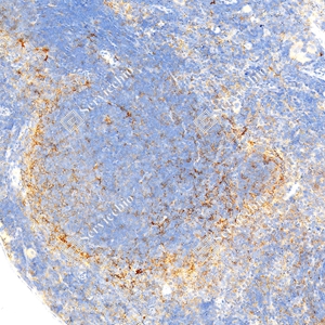 2 GB150059_PD-L1_mAb79_mAb7925071004_d1000_M spleen_15.0x_IHC.jpg