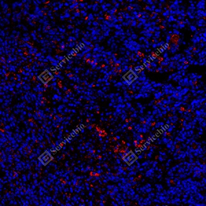 6 GB150059_PD-L1_red_mAb79_mAb7925071004_d1000_subcutaneous nude-mouse model of 4T1 cell_20.0x_IF.jpg