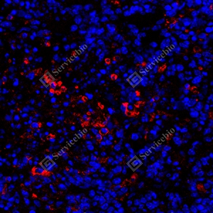 7 GB150059_PD-L1_red_mAb79_mAb7925071004_d1000_subcutaneous nude-mouse model of 4T1 cell_40.0x_IF.jpg