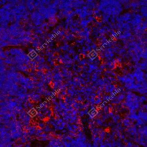 9 GB150059_PD-L1_red_mab79_mab7925071004_d1500_M thymus gland_24.1x_IF.jpg