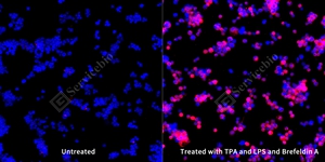 6 GB15113 20250801_IL-1_mAb73_mAb73250326 d1000 THP-1_20.0x_ICC_WM.jpg