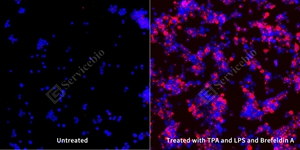 5 GB153968 20250801_TNF_mAb294_mAb29425062402 d100 THP-1_20.0x_ICC_WM.jpg