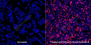 6 GB153968 20250801_TNF_mAb294_mAb29425062402 d100RAW264.7_20.0x_ICC_WM.jpg