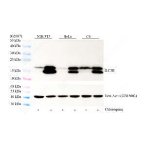 01WB1 GB153801_LC3B_mAb28325062402_d1000_WB_WM.jpg