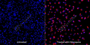 7 GB153801 20250815_LC3B_mAb283_mAb28325062402 d1000 HeLa _20.0x_ICC_WM.jpg