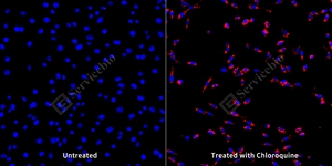 8 GB153801 20250815_LC3B_mAb283_mAb28325062402 d1000 NIH3T3_20.0x_ICC_WM.jpg