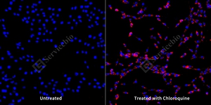 9 GB153801 20250815_LC3B_mAb283_mAb28325062402 d1000 PC12_20.0x_ICC_WM.jpg