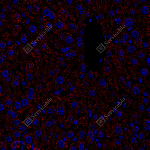 03 .M肝-7 7500 1：1000 IF ACADM红 J_53.4x_IF_WM.jpg