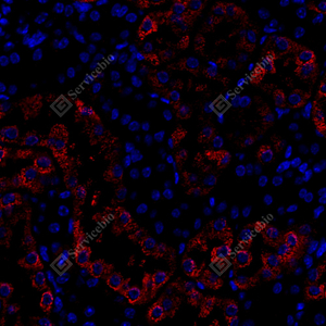 04 M肾 7500  1：1500 IF ACADM红 J_58.3x_IF_WM.jpg