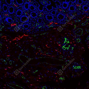 6 GB151689 20250801_LYVE1红_D01336_D0133625063001 d1600+CD31绿_GB12064_d600 H colon_10.0x_IF_WM.jpg