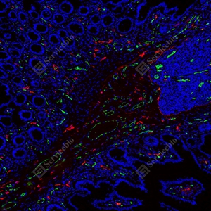 7 GB151689 20250801_LYVE1红_D01336_D0133625063001 d1600+CD31绿_GB12064_d600 H colon_10.0x_IF_WM.jpg