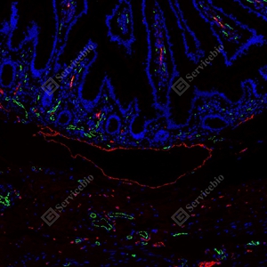 8 GB151689 20250801_LYVE1红_D01336_D0133625063001 d1600+CD31绿_GB12064_d600 H colon_10.0x_IF_WM.jpg