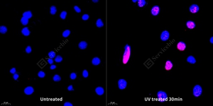 12 GB111841_200701_H2AX_6367_636720041702 A549 d200_40.0x_ICC_WM.jpg