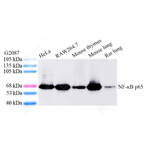 01WB1 GB11997_NFKBP65_S2044-04_d500_WB_WM - 副本.jpg