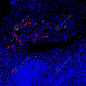 9 GB150126_CD1a_red_mAb126_mAb12625070302 d7000 H tonsil_15.0x_IF_WM.jpg