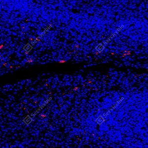 10 GB150126_CD1a_red_mAb126_mAb12625070302 d7000 H tonsil_20.0x_IF_WM.jpg