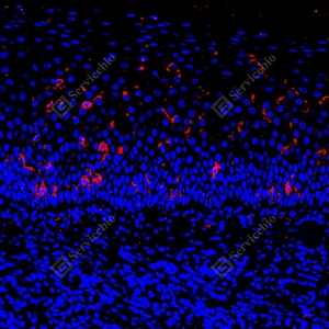 11 GB150126_CD1a_red_mAb126_mAb12625070302 d7000 H tonsil_24.0x_IF_WM.jpg