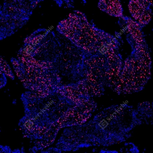 13 YB151304_Topoisomerase II alpha_red_mAb123_mAb12325082602 d500 H cervical carcinoma_5.0x_IF_WM.jpg
