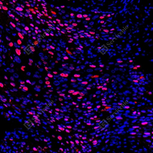 14 YB151304_Topoisomerase II alpha_red_mAb123_mAb12325082602 d500 H cervical carcinoma_20.0x_IF_WM.jpg