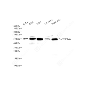 01WB1 YB15190_TGF beta 1_M043_d1000_WB_WM - 副本.jpg