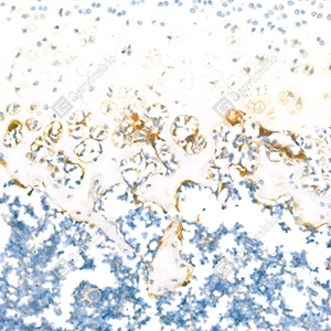 1 GB11416_ Tartrate Resistant Acid Phosphatase _R bone injury _d400_24.1x_IHC_WM.jpg