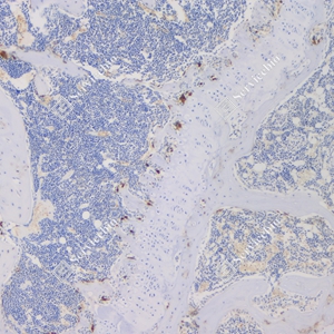 2 GB11416_ Tartrate Resistant Acid Phosphatase _M bone injury _d500_24.1x_IHC_WM.jpg