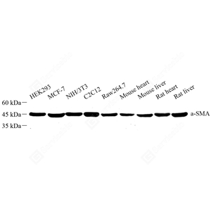 01WB1 GB111364_alpha smooth muscle Actin_d1000_WB_WM.jpg