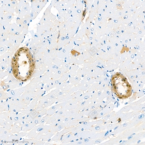 04 GB111364_alpha smooth muscle Actin_4944_d800_M heart_34.4x_IHC_WM.jpg