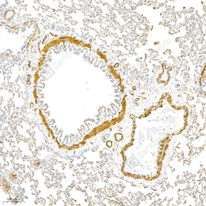 05 GB111364_-sma_4944_M lung d800_8.2x_IHC_WM.jpg