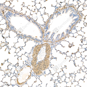 06 GB111364_alpha smooth muscle Actin_4944_d800_R lung_11.7x_IHC_WM.jpg