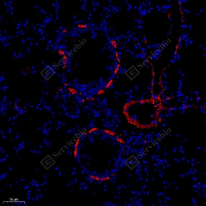 08 GB111364_alpha smooth muscle Actin_red_4944_d600_M lung_20.0x_IF_WM.jpg