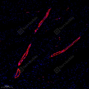 09 GB111364_alpha smooth muscle Actin_red_4944_d600_R heart_11.9x_IF_WM.jpg