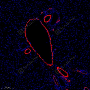 10 GB111364_alpha smooth muscle Actin_red_4944_d600_R liver_12.8x_IF_WM.jpg