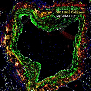 11 H lung  collagen I GB11022-3 红色 -SMA GB111364 绿色 collagen III GB111629 黄色 +CD31 GB12064 白色 四标_36.4x_IF_WM.jpg