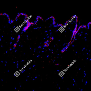 14 GB150132_EGFR_red_D01591_D0159125081401 d600 M Skin_20.0x_IF_WM.jpg