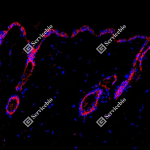 15 GB150132_EGFR_red_D01591_D0159125081401 d600 M Skin_25.0x_IF_WM.jpg