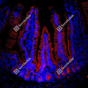 16 GB150132_EGFR_red_D01591_D0159125081401 d600 M Small intestine_20.0x_IF_WM.jpg