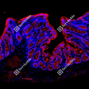 17 GB150132_EGFR_red_D01591_D0159125081401 d600 R colon_15.0x_IF_WM.jpg