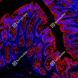 18 GB150132_EGFR_red_D01591_D0159125081401 d600 R colon_20.0x_IF_WM.jpg