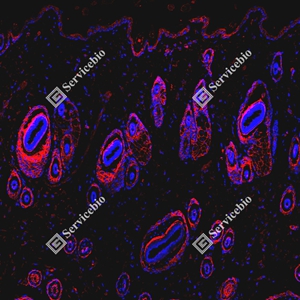 19 GB150132_EGFR_red_D01591_D0159125081401 d600 R Skin_10.0x_IF_WM.jpg