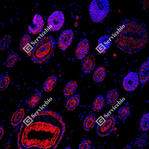 20 GB150132_EGFR_red_D01591_D0159125081401 d600 R Skin_15.0x_IF_WM.jpg