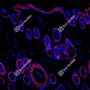 21 GB150132_EGFR_red_D01591_D0159125081401 d600 R Skin_15.0x_IF_WM.jpg