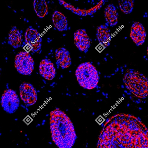 22 GB150132_EGFR_red_D01591_D0159125081401 d600 R Skin_20.0x_IF_WM.jpg